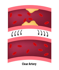 Blood Arteries